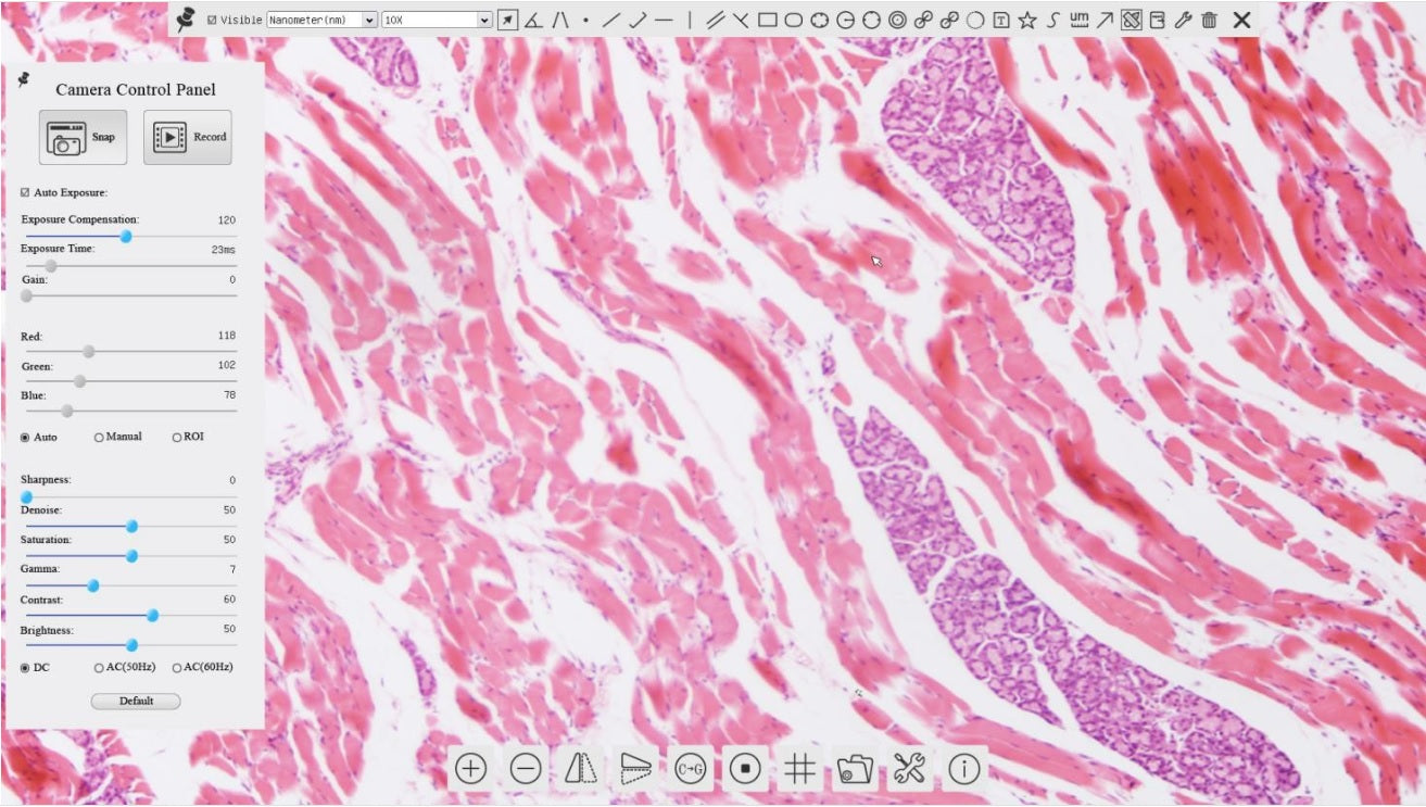 1080p microscope camera live screen view showing high-resolution tissue sample and on-screen measurement software menu.